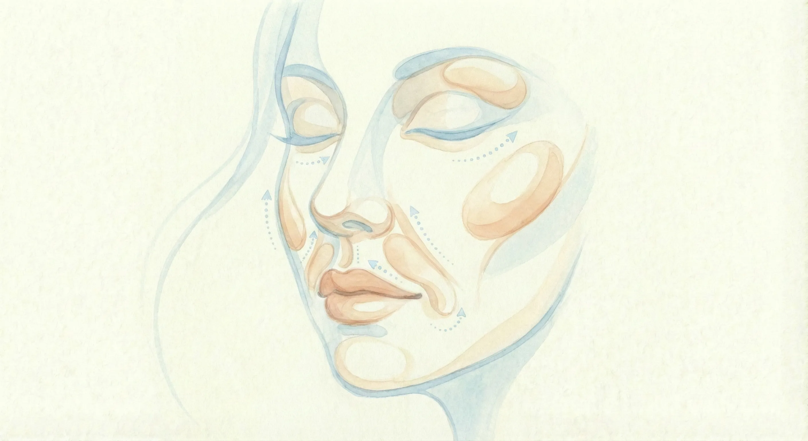 Fillers hyaluronzuur behandeling